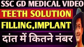 जान लो दाँत के बारे में | Ssc Gd Teeth Medical | Ssc Gd Teeth Test | Ssc Gd Medical News | Ssc Gd