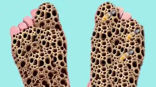 ASMR ANIMATION TREATMENT FROM FOOT SOLE  @asmr100