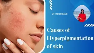 What are the main causes of Hyperpigmentation? | Patient education I MIC