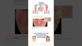 Новая большая лекция по СЕБОРЕЙНОМУ ДЕРМАТИТУ