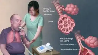CHEST Foundation Patient Education