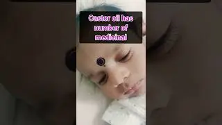 Which oil is best for baby massage? Uses of it 