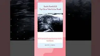 Hamil Tapi Suntik KB? Ini yang Perlu Kamu Ketahui 