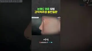 눈 아파서 병원 갔더니 척추 때문?