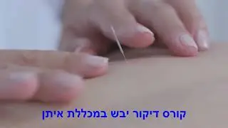 קורס דיקור יבש במכללת איתן - טכניקת הדיקור בנקודת טריגר