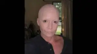 Bald Cap Tutorial