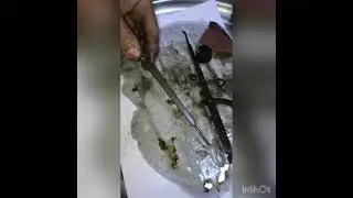 İç kumpas restorasyon