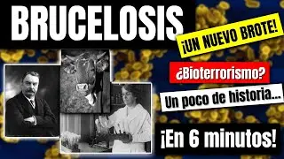 Brucelosis