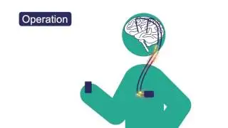 Parkinson Erklärfilme 1 - Was bedeutet Parkinson?