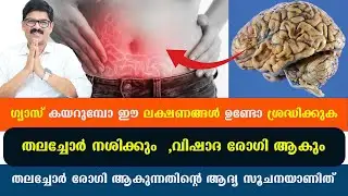 വയറ്റിൽ ഗ്യാസ് ഈ ലക്ഷണങ്ങളോടെ ആണോ തലച്ചോർ നശിക്കുന്നതിന്റെ ആദ്യ ലക്ഷണമാണ് അവഗണിക്കരുത് / Dr Shimji