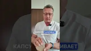 Что такое риплинг после маммопластики (волнистость и рябь на импланте) и как с этим бороться?  ⬇️