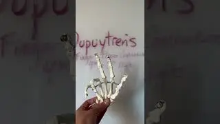 Hand Deformities in under 60sec. #anatomy. #dpt  #studyhack