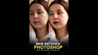High-End Skin Retouching | Face Retouching in Photoshop