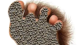 ASMR ANIMATION TREATMENT FOOT Fingers  @asmr100