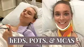 How Ehlers Danlos Syndrome Affects My Life