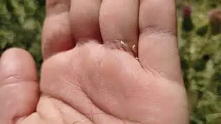 Rastaropsha jigarni tabiy davolash. Жигарни табий тозалаш