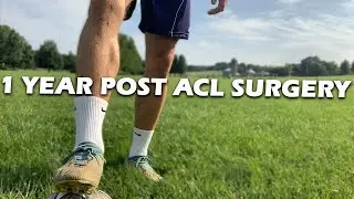 1 YEAR POST ACL SURGERY