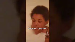 Viral Hair Growth Oil | Black Girls with Long Hair | Scalp Care Tips