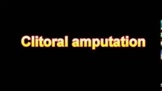What Is The Definition Of Clitoral amputation - Medical Dictionary Free Online