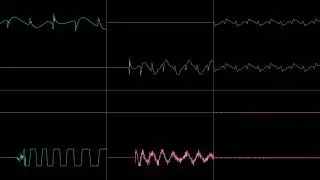 The Charlatan / Epinicion - going home (oscilloscope view, s3m)