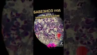 Бабезиоз. подробнее в инстаграмм