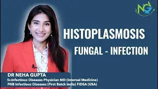 Histoplasmosis I Fungal Infection #fever#weightloss #soilbornefungus#publichealthawareness#ngswastha