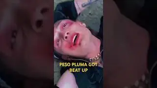 Why did peso pluma get beat up 
