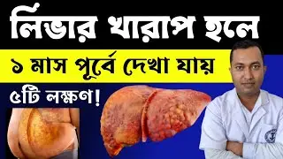 লিভারের সমস্যা থেকে মুক্তির উপায়
