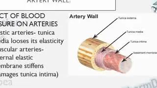HYPERTENSION (PART-1)