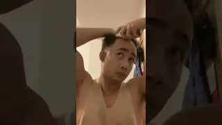 Applying Minoxidil Strands for Hair Growth #minoxidil
