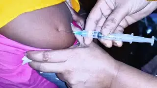 IM Intramuscular Arm injection Push. Ketorolac 30 mg Xerokit.  24 Ep 106 Anik Health Tips