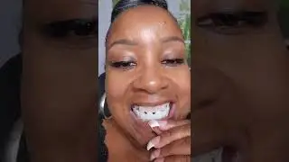 Pop On Veneers!