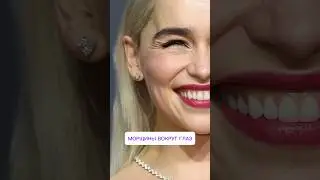 МОРЩИНЫ ВОКРУГ ГЛАЗ 👀ждем вас в косметологии доктора Корчагиной Москв ул Минская 1гК2 #гусиныелапки