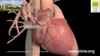 Heart Failure Overview - Detailed (Gujarati) - CIMS Hospital