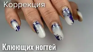 КОРРЕКЦИЯ  КЛЮЮЩИХ НОГТЕЙ . Виктория Авдеева