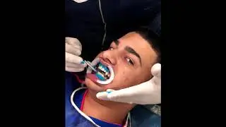 fraje 4 caras