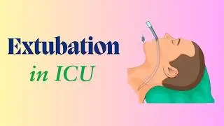 Extubation in ICU II Extubation in Oro-facial Surgery II Ventilator weaning