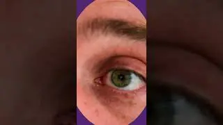Su OJO ahora es una CÁMARA de VÍDEO #shorts #robot