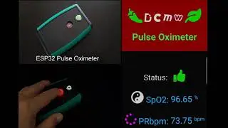 ESP32 Pulse Oximeter