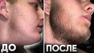 Вот как работает средство для роста бороды / Результаты mr Volos