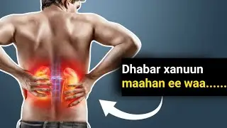 Ka Fogoow Cuntooyinkan! Waxay Sababaan Dhagxaan Kiliyaha Ku Sameeysma