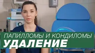 Папилломы и кондиломы / Удаление папиллом / Нужно ли удалять кондиломы