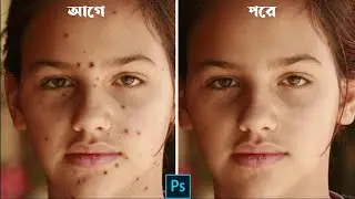 How To Remove Dark Spot in a Photo with Photoshop Bangla Tutorial