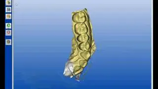 Cerec AC Quadrant Optical Scan