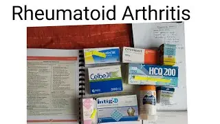 Rheumatoid Arthritis , clinical features, diagnosis and treatment ..