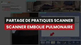 CT Scanner EMBOLIE PULMONAIRE - Partage de pratiques