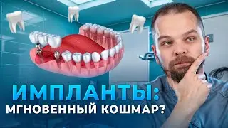 Имплантация за один день: Чудо или кошмар?