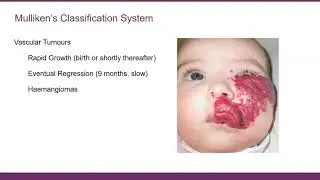 Vascular Webinar - Hamish McNair