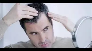 What Causes White Hair Is Hydrogen Peroxide & Free Radicals