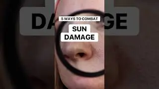 How to combat SUN DAMAGE☀️ #sundamage #sunspots #skintreatment